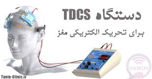 تحریک الکتریکی مغز (TDCS) 