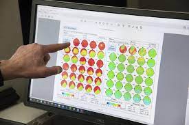  دستگاه QEEG الکتروانسفالوگرافی کمیتی